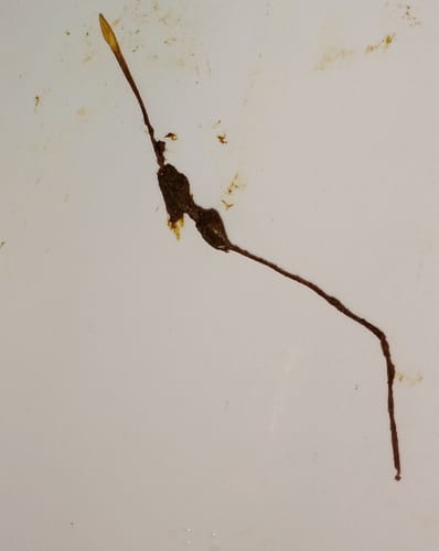 Customer photo review of Paragon | Parasite Cleanse