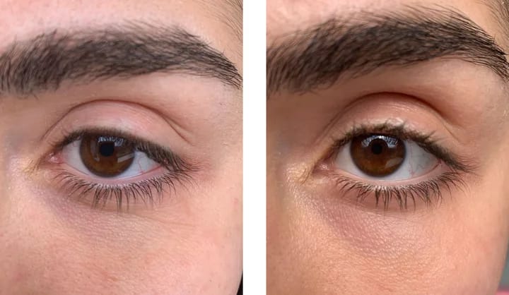 Customer photo review of Bliss™- Collageen Proteine