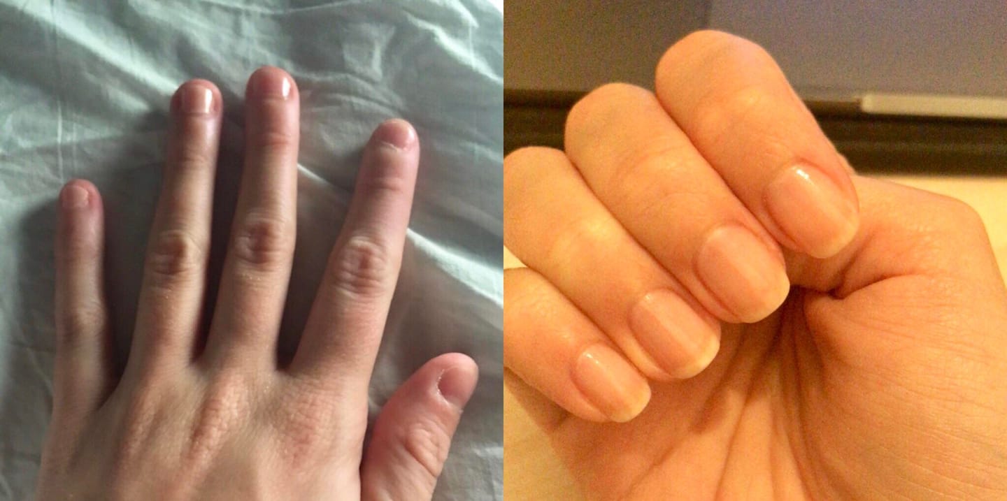 Customer photo review of Bliss™- Collageen Proteine