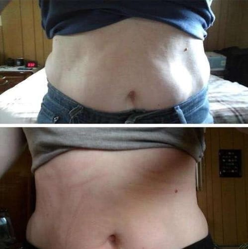 Customer photo review of Diystar™ Lymphdrainage-Ingweröl – Aktion für den letzten Tag