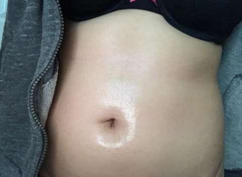 Customer photo review of Diystar™ Lymphdrainage-Ingweröl – Aktion für den letzten Tag