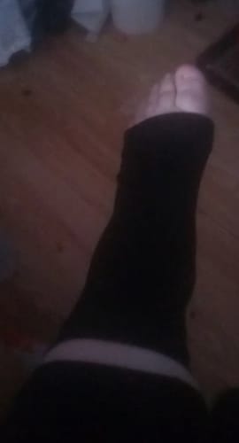 Customer photo review of Medisox™ Kompressionssocken