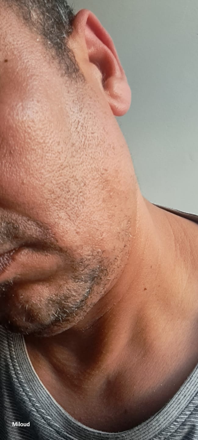 Customer photo review of Sérum Thorin | Huile de croissance de Barbe