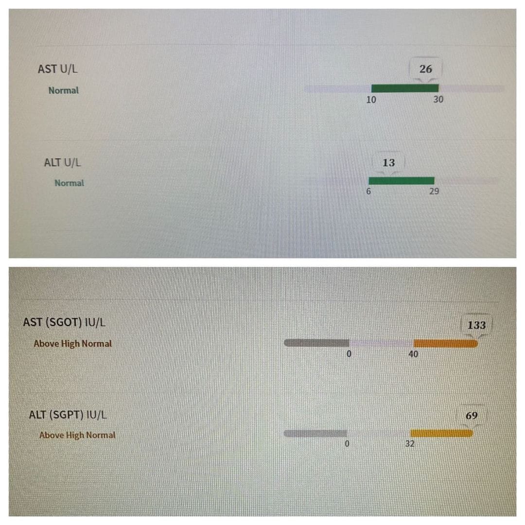 Customer photo review of Women's Gut Rebalance Kit