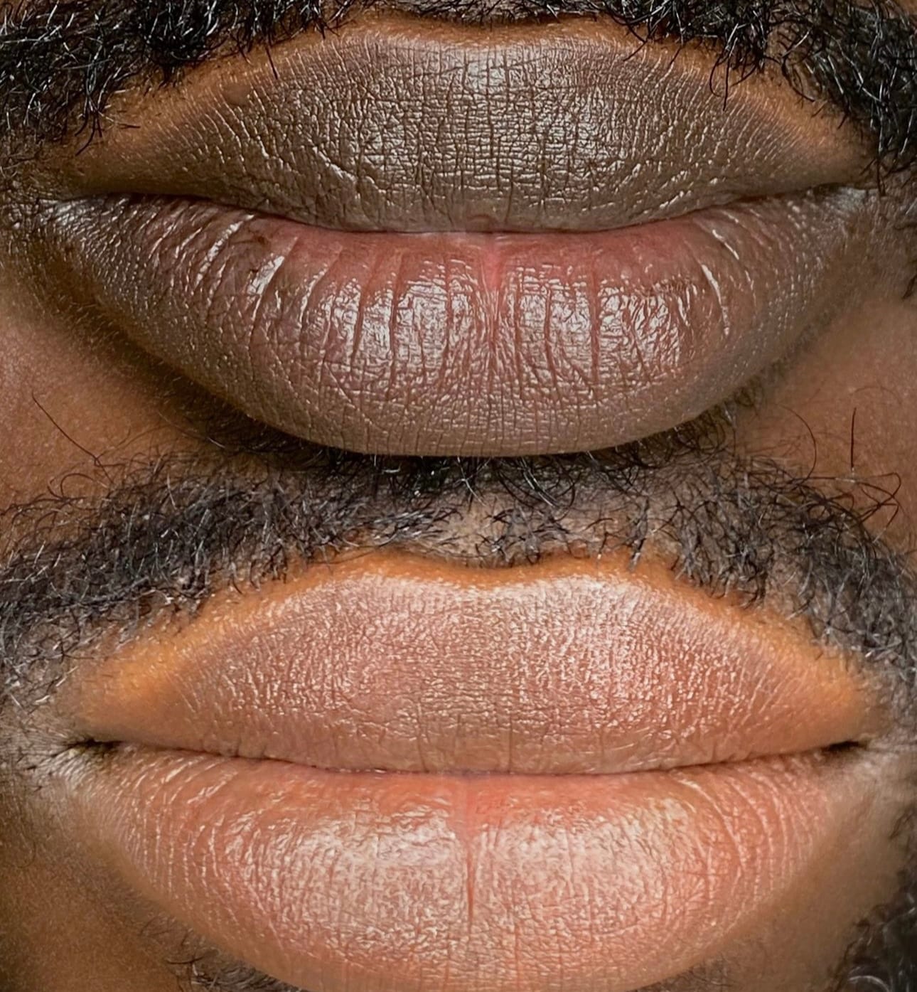Customer photo review of Pink Lip Kit