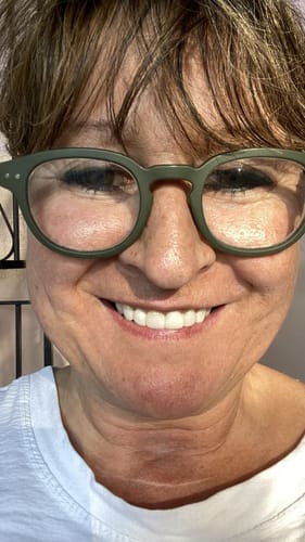 Customer photo review of Teeth-Veneer 2.0