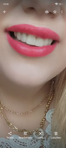 Customer photo review of Teeth-Veneer 2.0