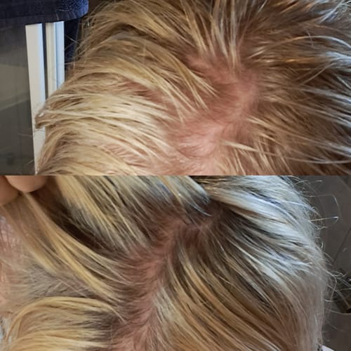 Customer photo review of Sunkissed Refill 3-pack