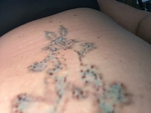 Customer photo review of TattooNumbx Numbing Cream