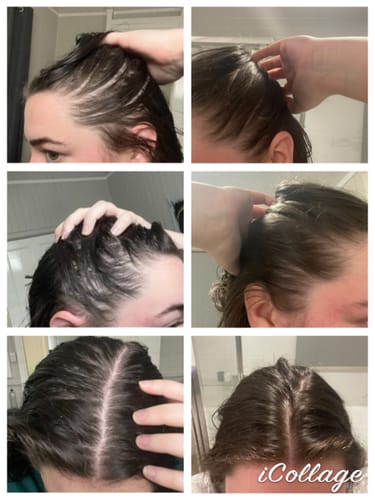 Customer photo review of Pre-Wash Scalp Oil by TR