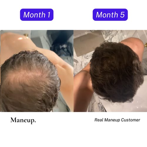 maneup ghk cu Does it work? Maneup GHK-Cu hair growth serum : r/tressless main image 1