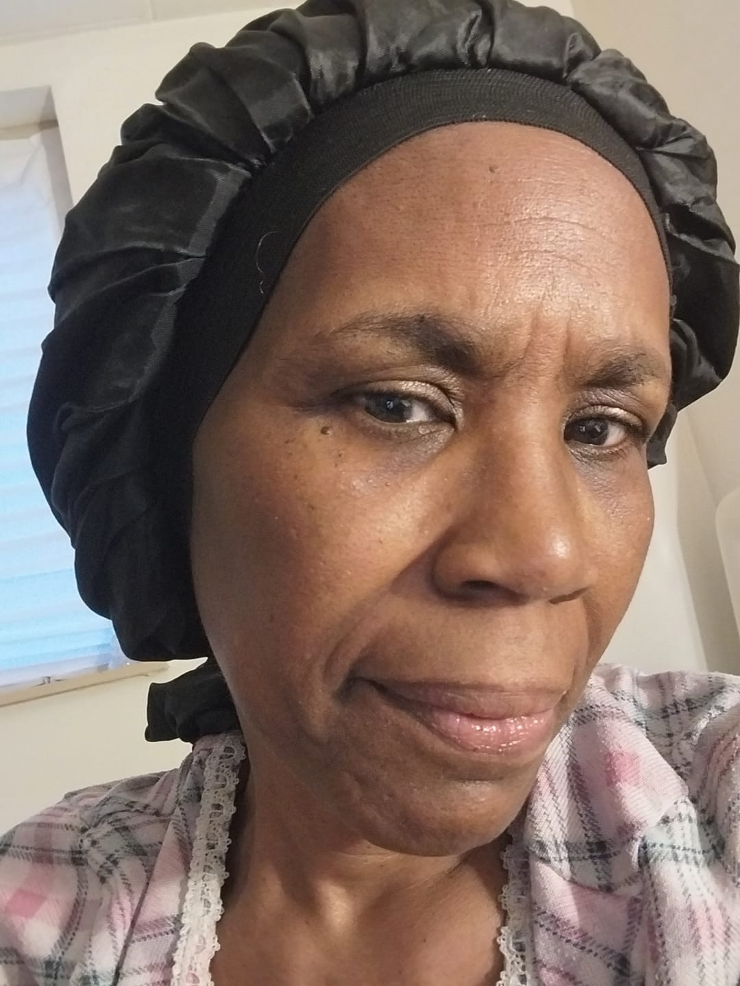 Customer photo review of Dark Spot Micro Dart Patches (with Turmeric)