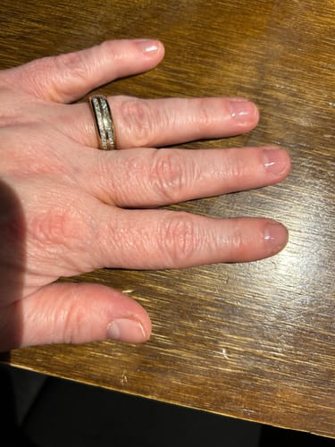 Customer photo review of Rocket Nail Fuel Nail Repair - Purple