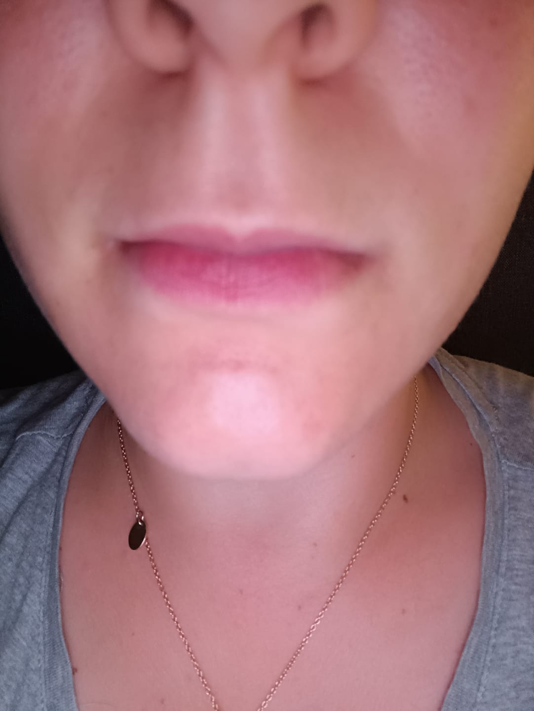 Customer photo review of Revitalisierendes Gesichtswasser Rosenhydrosol Glykolsäure 5% & AHA+BHA