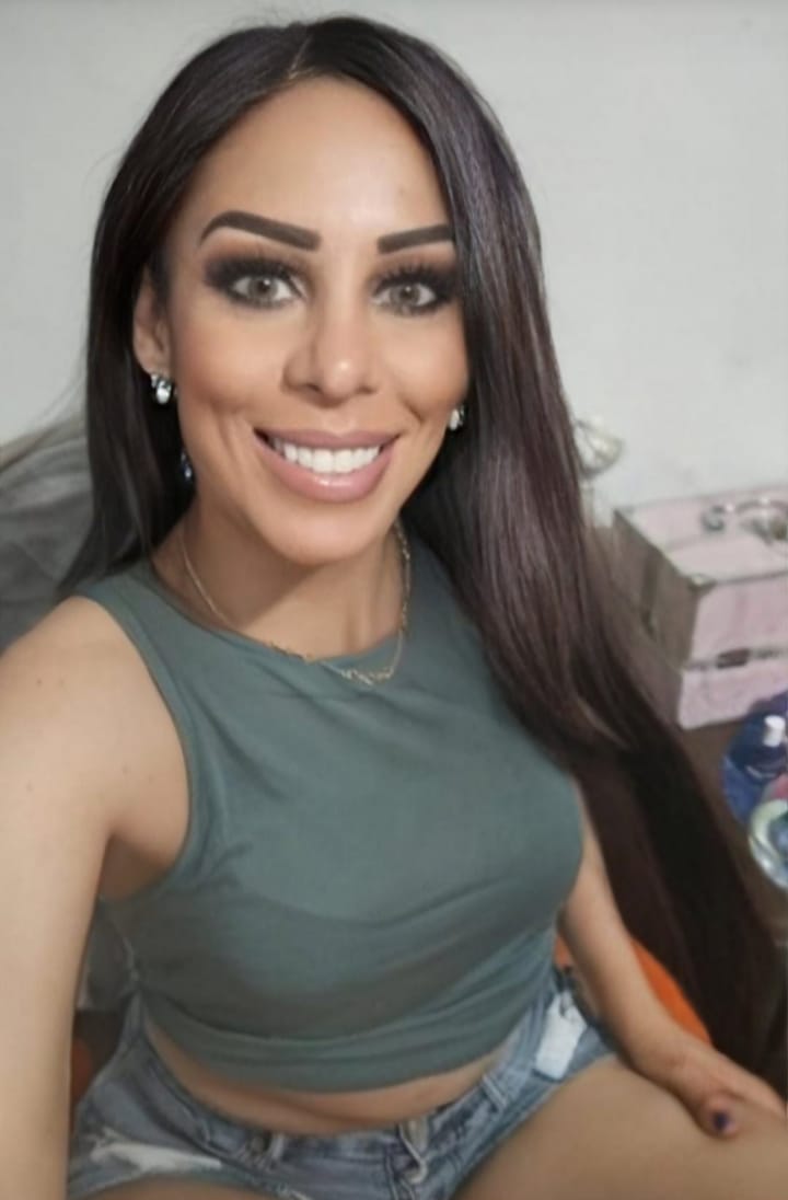 Customer photo review of Elite Sandy Gray Prescription Colored Contact Lenses