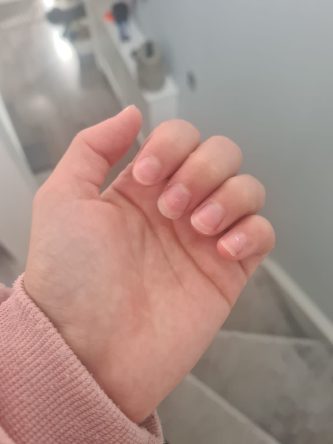 Customer photo review of Nourishing Cuticle Oil Pen & Gellae Nail Remover