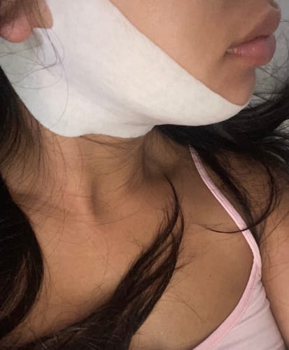 Customer photo review of V Mask™