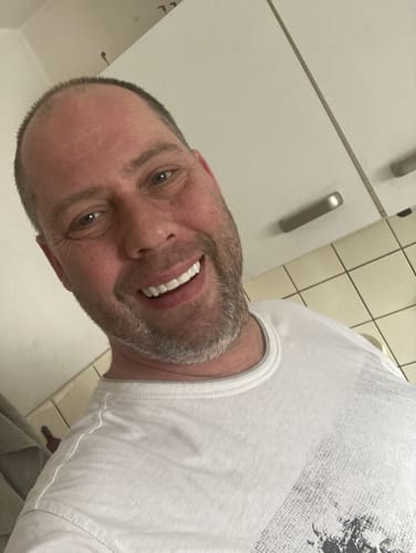 Customer photo review of Teeth-Veneer 2.0