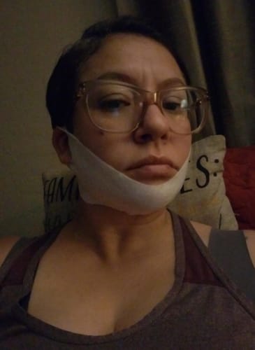 Customer photo review of V Mask™