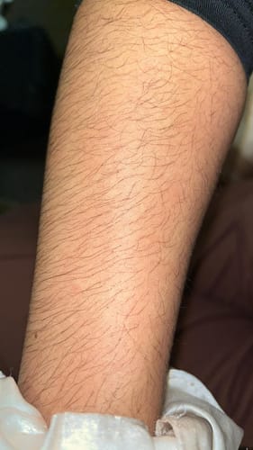 Customer photo review of 1x Belle Body Haarentfernung