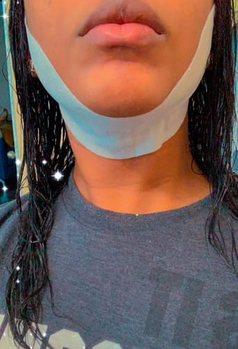 Customer photo review of V Mask™