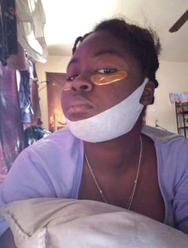 Customer photo review of V Mask™