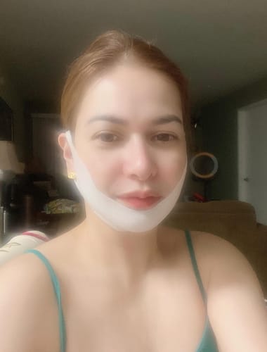 Customer photo review of V Mask™