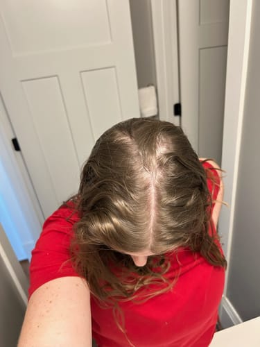 Customer photo review of Pre-Wash Scalp Oil by TR