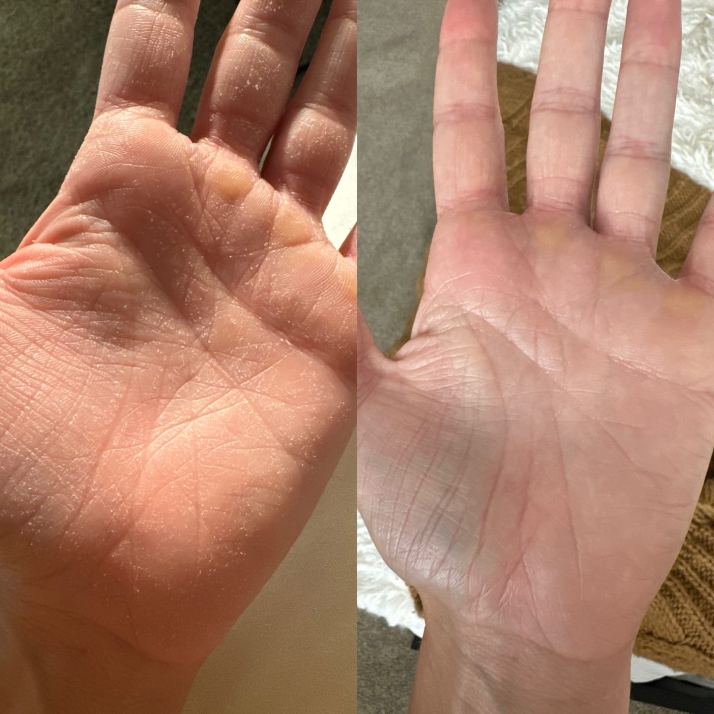 Customer photo review of Vitalize Tallow Balm