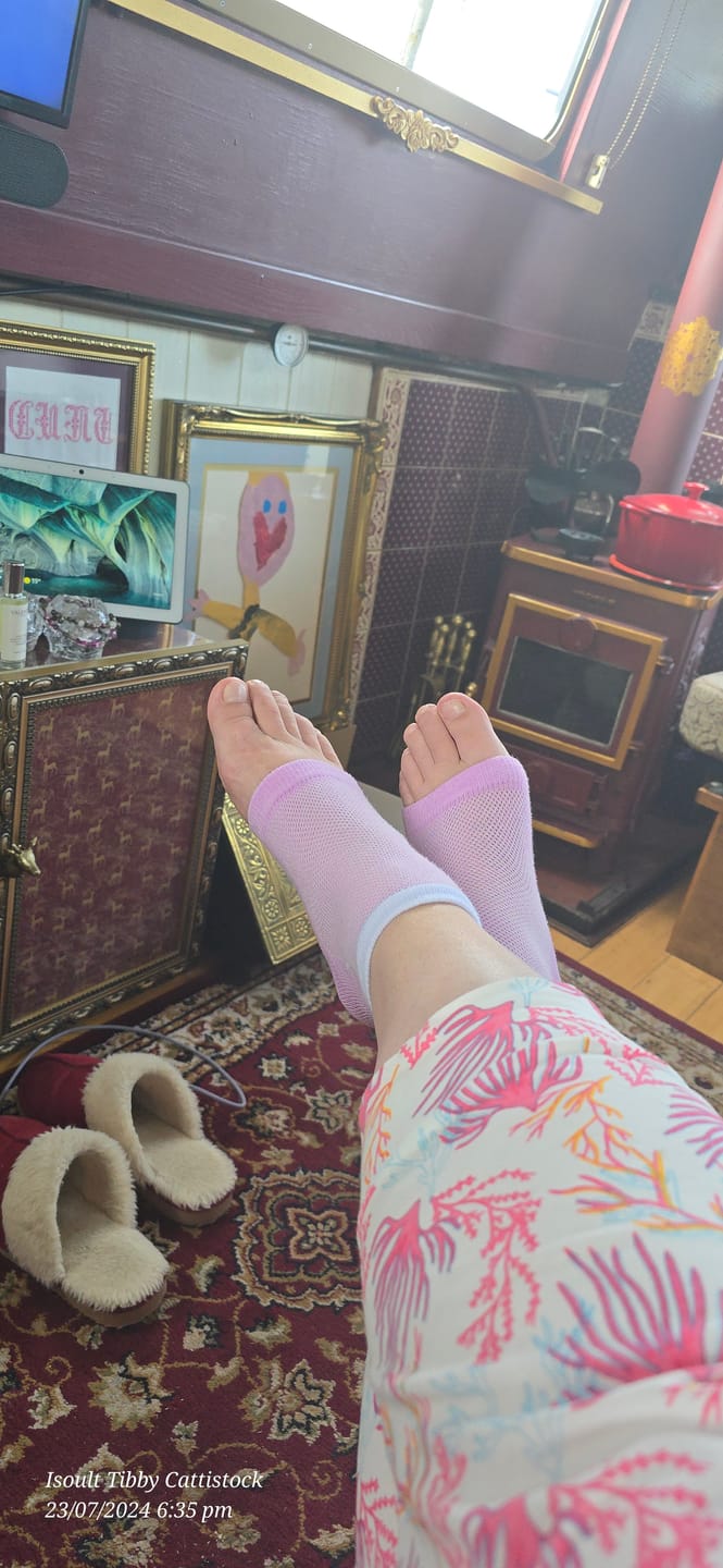 Customer photo review of XL Glass Foot File and Heel Sock Bundle