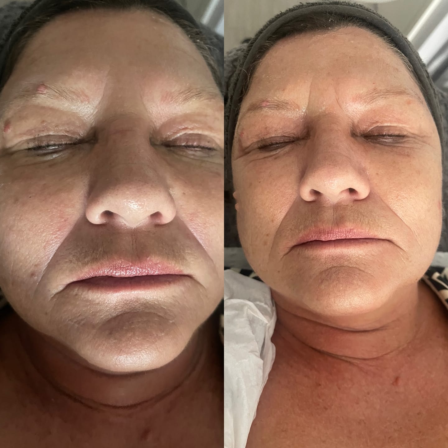 Customer photo review of WOW fusion® Device