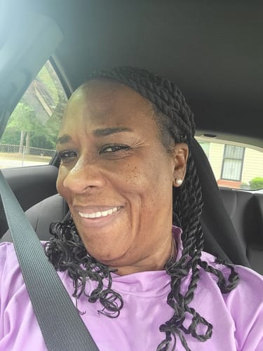 Customer photo review of Fair and White So White Skin Perfector Gel 30ml / 1 fl oz