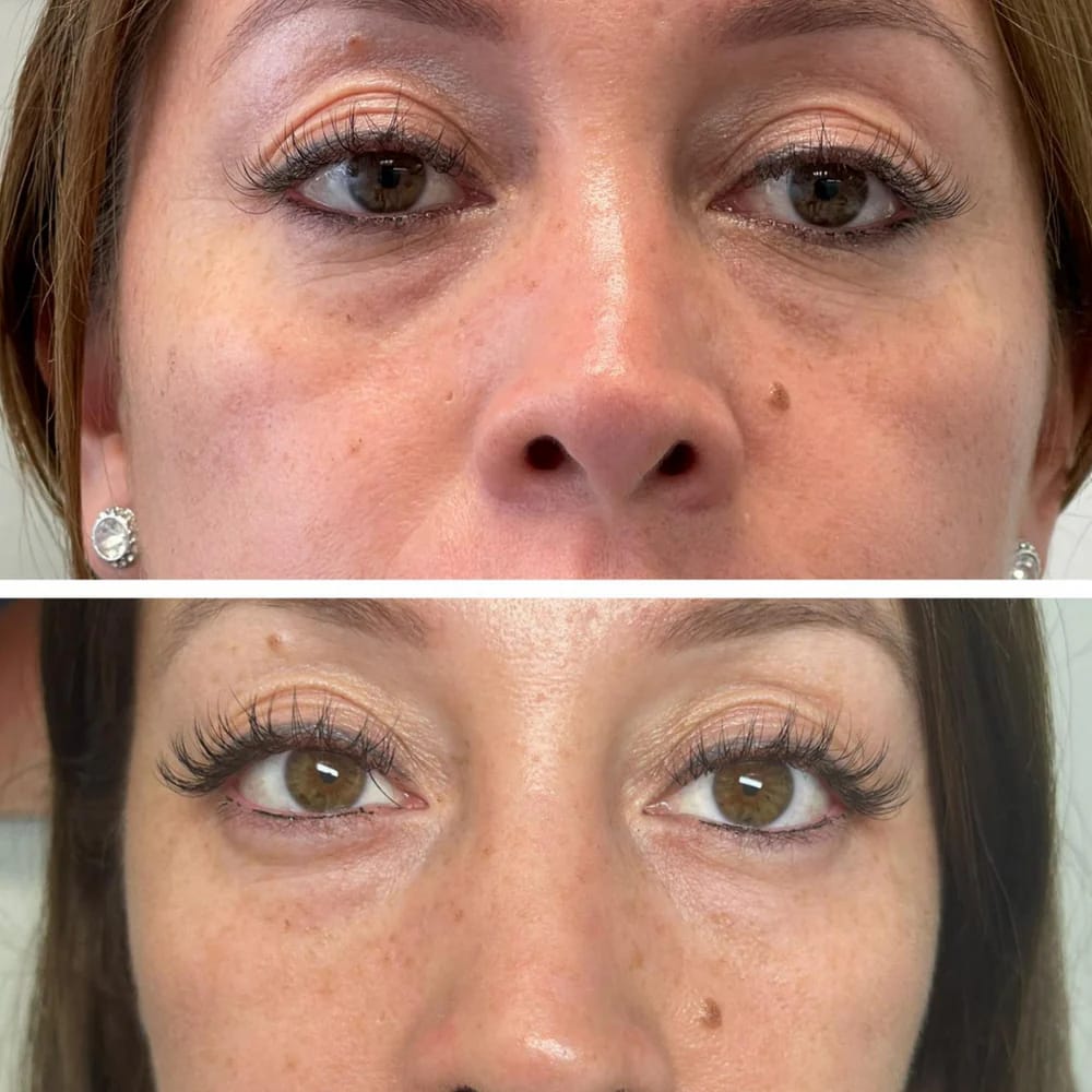 Customer photo review of Under Eye Skincare Wand