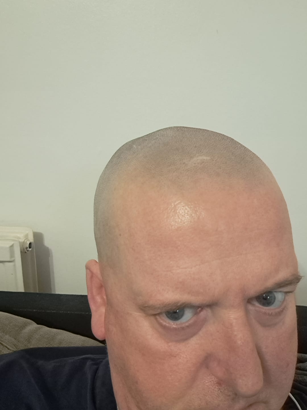 Customer photo review of Trimpod 3.0: The Ultimate Shaver for Bald Men