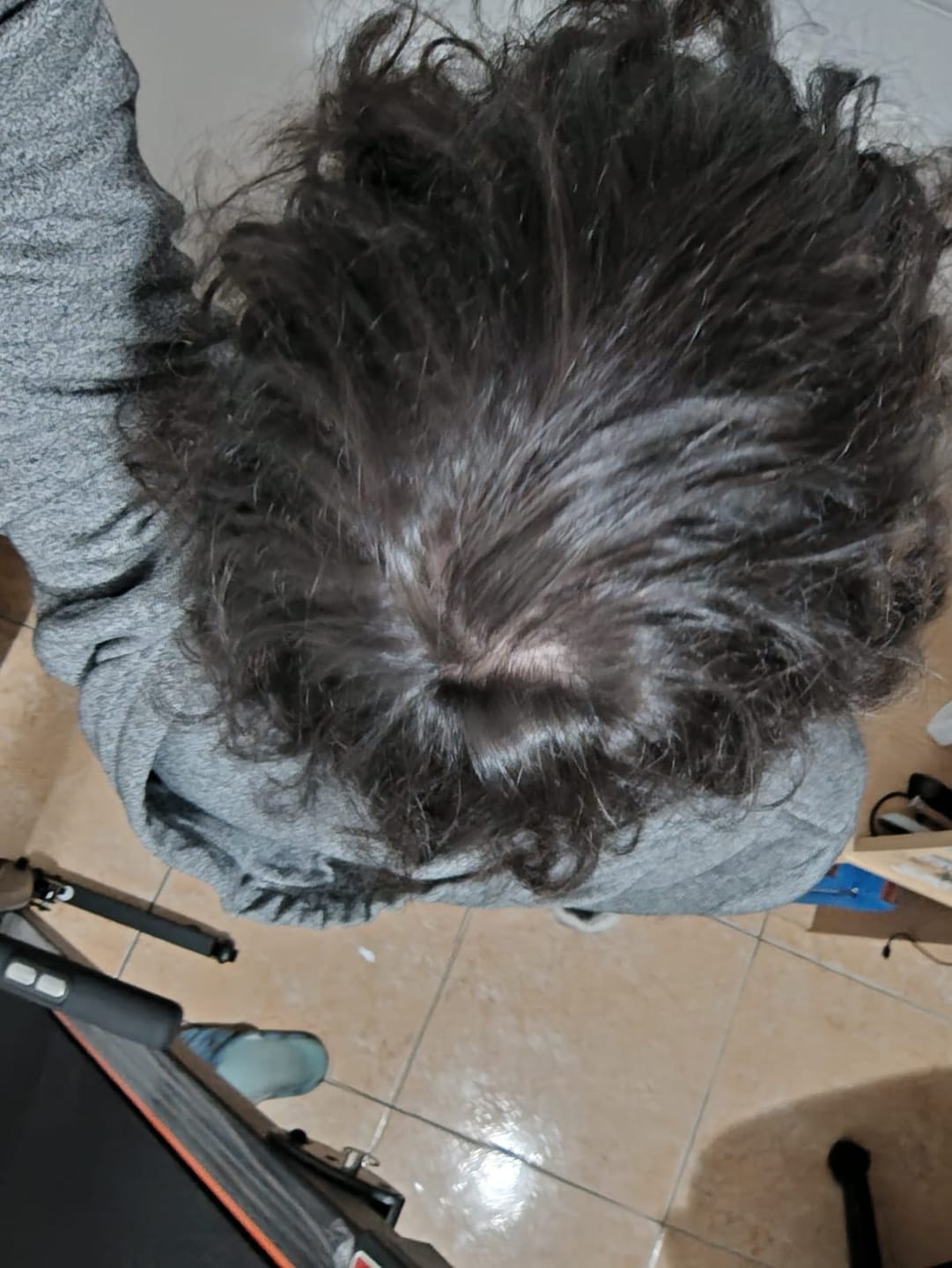 Customer photo review of Anticaída para 3 meses