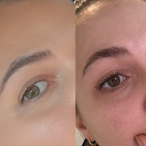Customer photo review of LASH SERUM