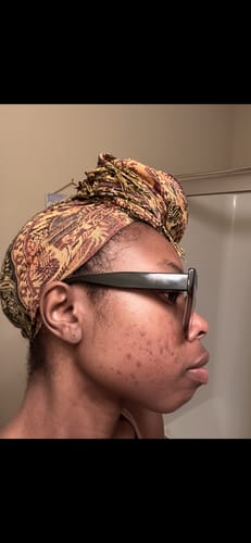Customer photo review of LIMITED EDITION KIT Jolie’s Mini Full Body & Face Brightening Kit