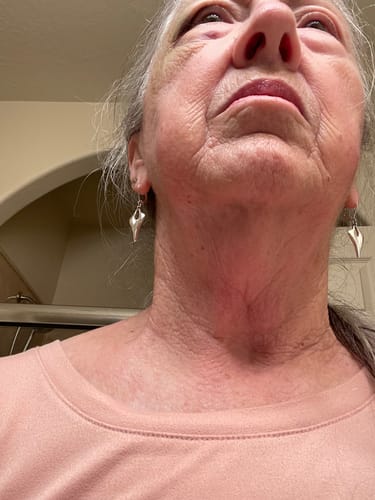 Customer photo review of Face & Neck Deluxe System