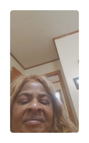 Customer photo review of Omic LightenUp PLUS Exfoliating Soap - 200g