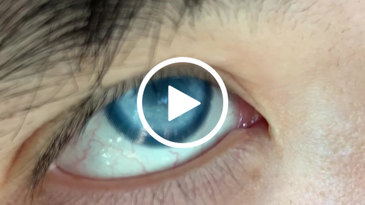 Customer video review of BJD Crystal Blue