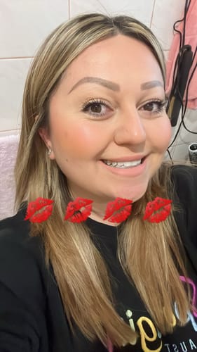 Customer photo review of Vitamin C serum