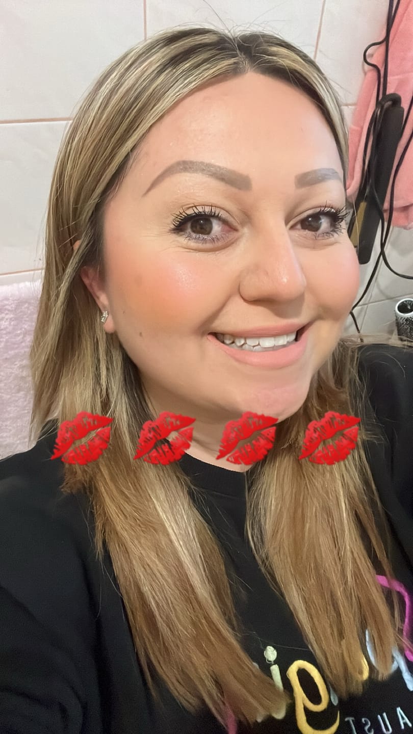 Customer photo review of Vitamin C serum