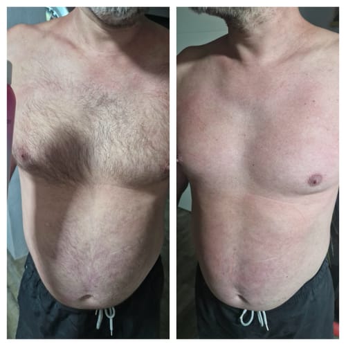 Customer photo review of 1x Belle Body Haarentfernung