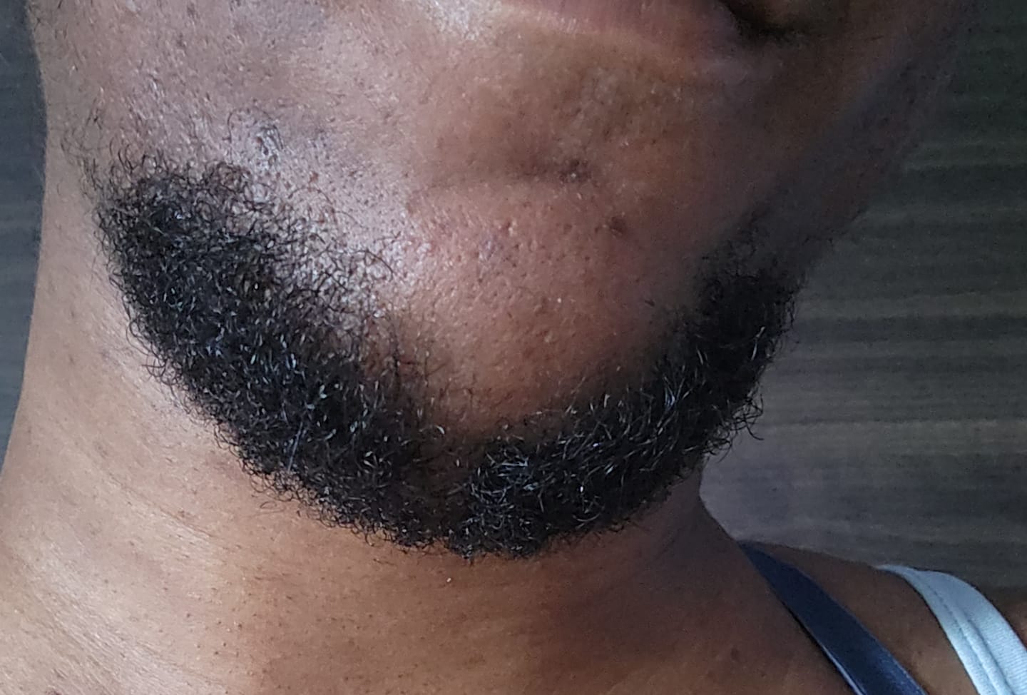 Customer photo review of Men’s Healthy Hair and Beard Starter Kit