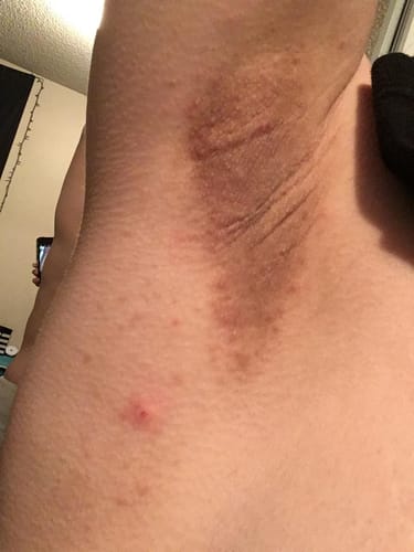 Customer photo review of Intimate Lightening Cream
