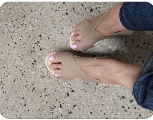 Customer photo review of CHLOE™ WOMEN'S STYLISH ORTHOPEDIC SANDALS 2024