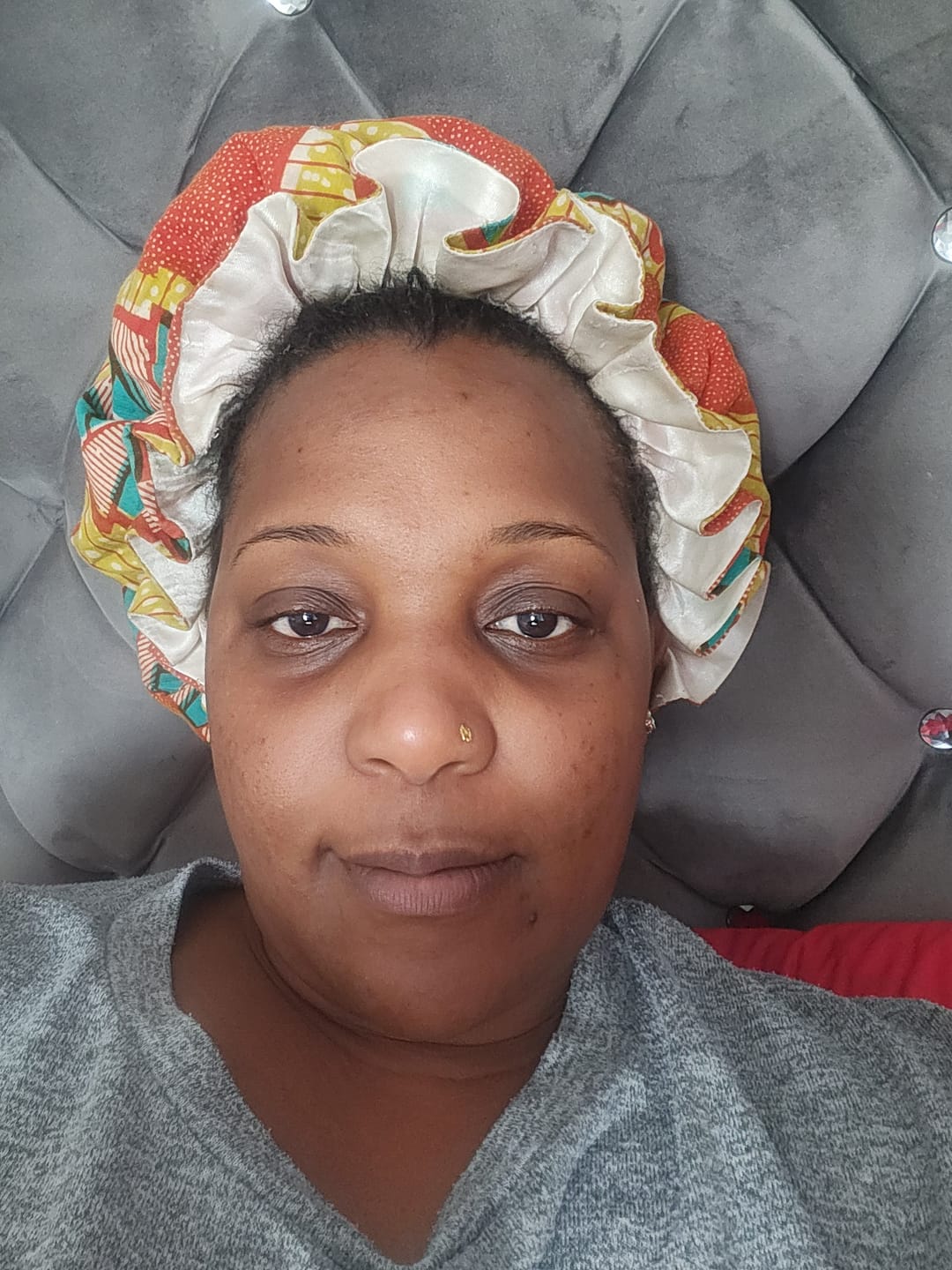 Customer photo review of Dark spots + Glow combo(offer ends today)
