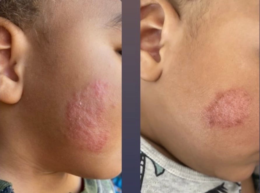 Customer photo review of Children’s Gut Rebalance Kit