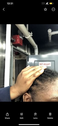 Customer photo review of Hair Growth Duo