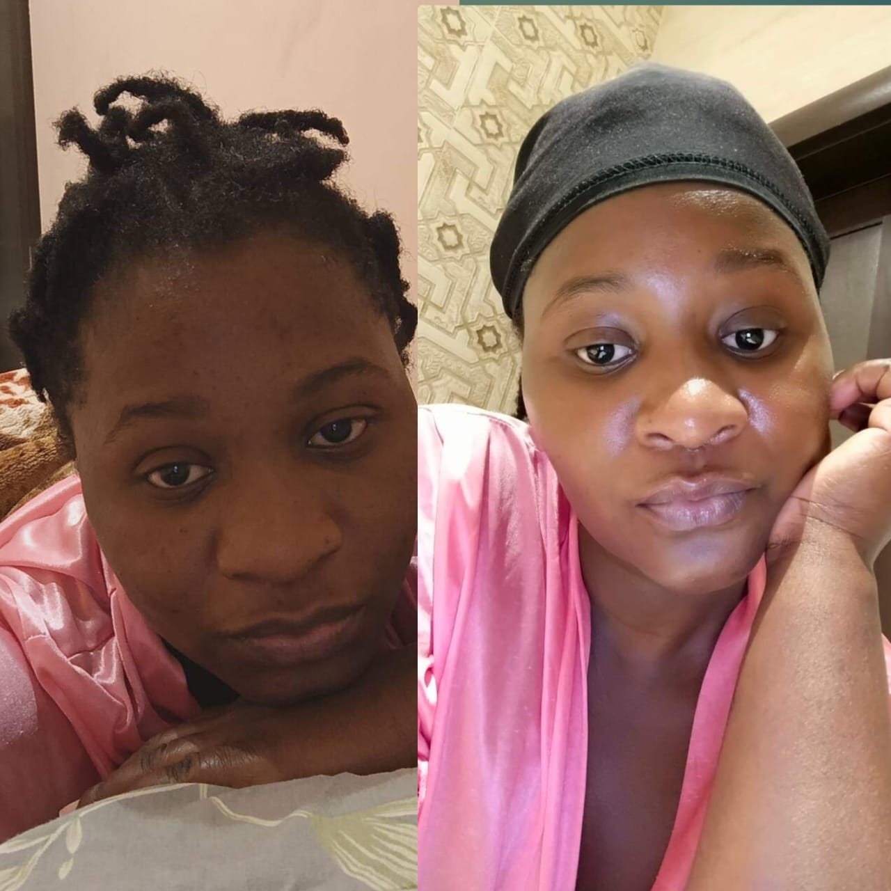 Customer photo review of Dark spots + Glow combo(offer ends today)
